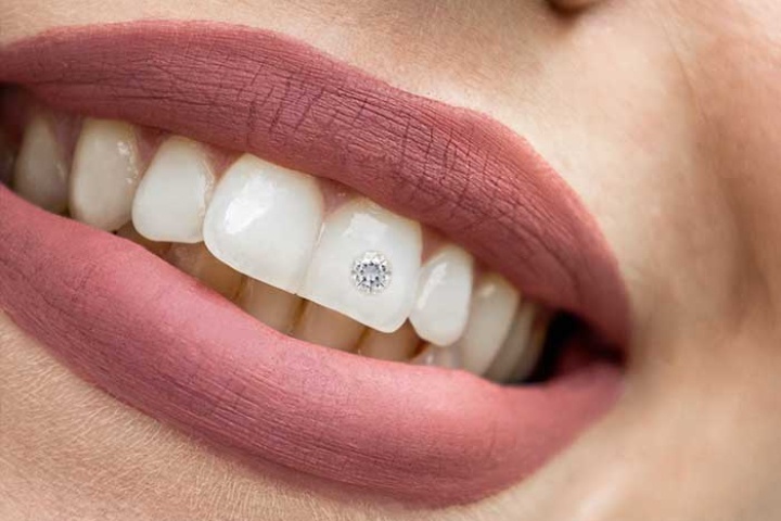 Pioneers Dental Center photo 3