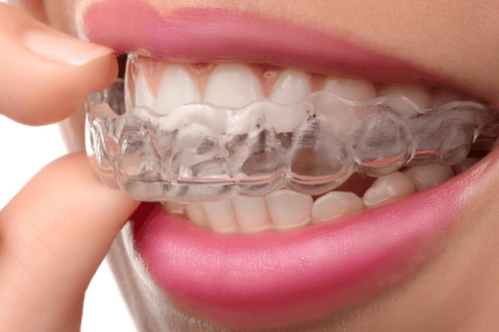 Pioneers Dental Center photo 5